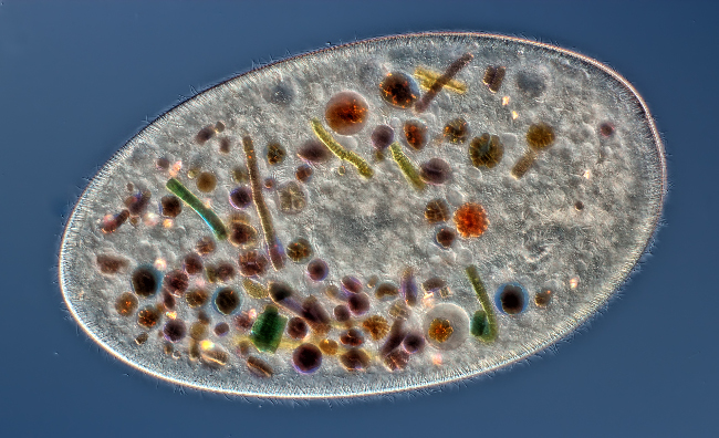 10th Place – Frontonia (showing ingested food, cilia, mouthand trichocysts) in differential interference contrast at 200x. Image: Rogelio Moreno Gill/ Nikon Small World Photomicrography Competition