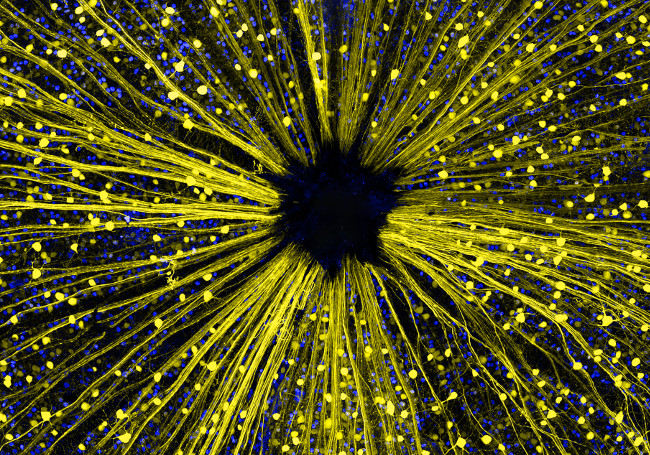 14th Place – Mouse retinal ganglion cells in fluorescence/confocal at 40x. Image: Dr. Keunyoung Kim/ Nikon Small World Photomicrography Competition