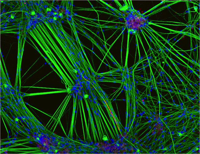 3rd Place –  Culture of neurons (stained green) derived from human skin cells, and Schwann cells, a second type of brain cell (stained red) in confocal/immunofluorescence/iPSCs at 20x. Image: Rebecca Nutbrown/ Nikon Small World Photomicrography Competition