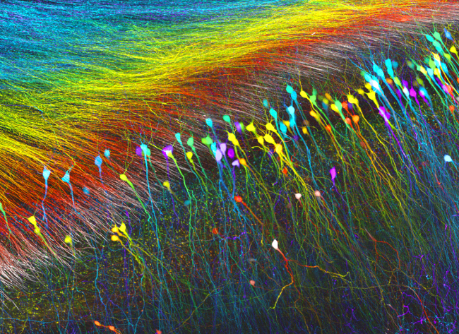 Nikon Small World Photomicrography Competition: Hippocampal neurons, in confocal at 10x. Image: Dr. Wutian Wu, University of Hong Kong
