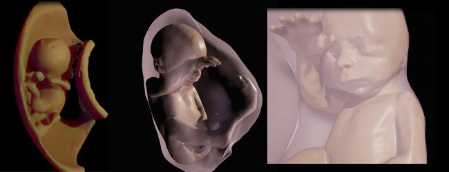 3D unborn baby