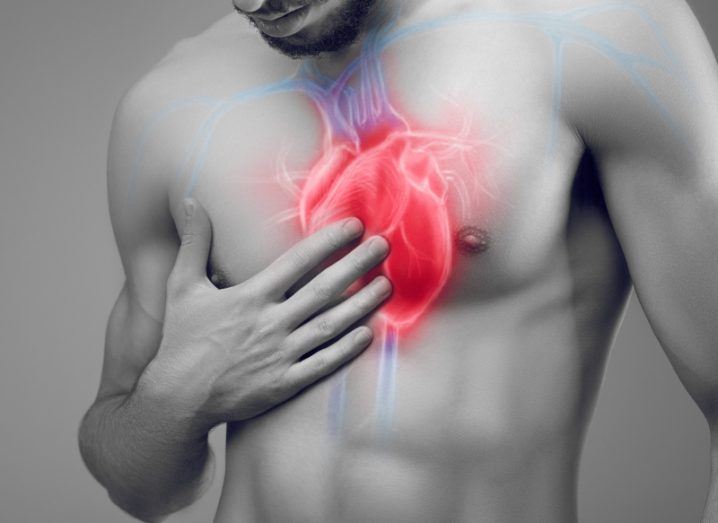 Heart surgery. Image: Bluskystudio/Shutterstock