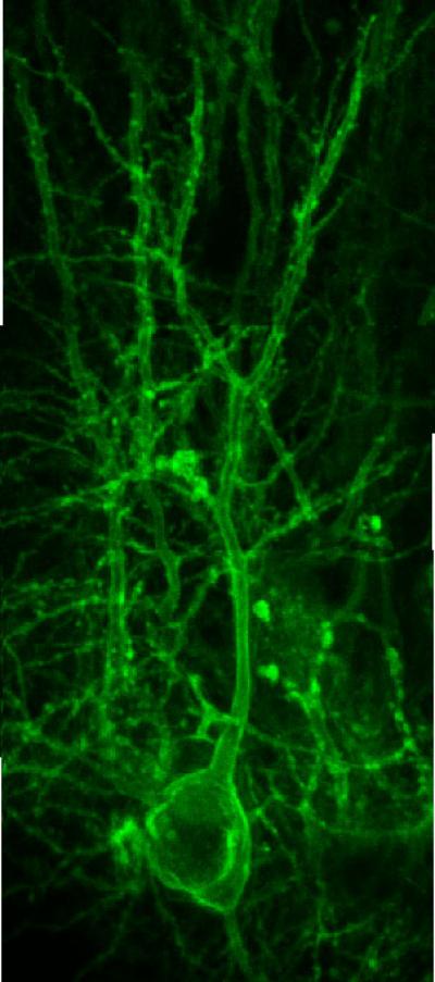 A web of green, fluorescent neurons against a black background.