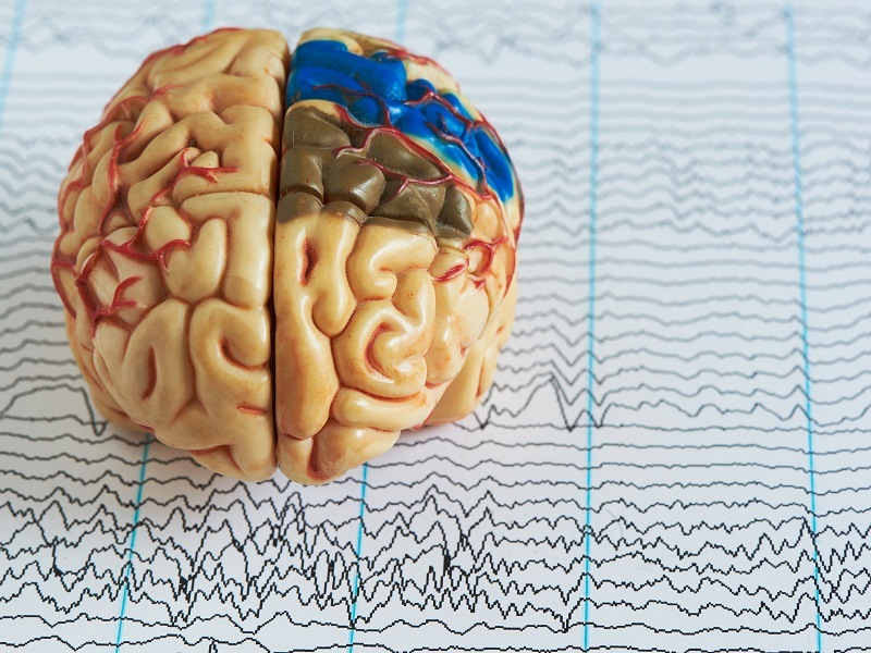Human brain model on a background of brain waves from electroencephalography.