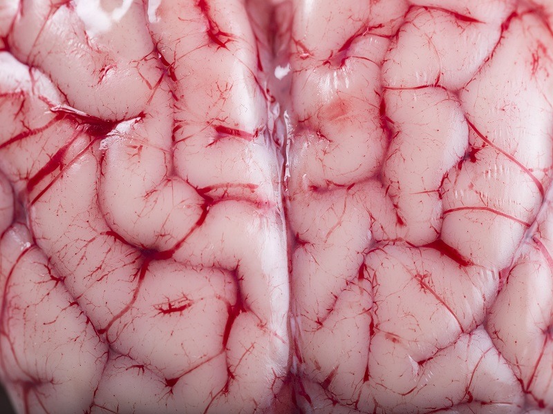 Close-up of a pink brain with red veins.