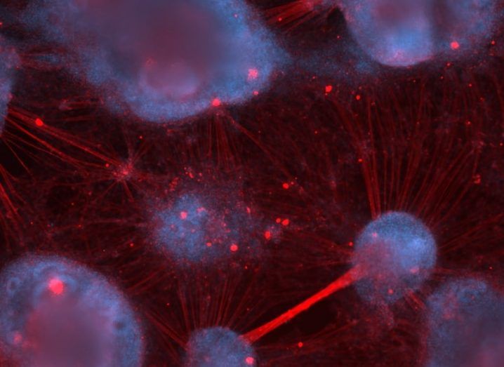 Blue bulbous neuron cells connected by a mesh of red.