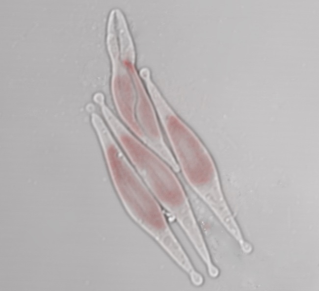 Microscopic image of Phaeodactylum tricornutum diatoms.