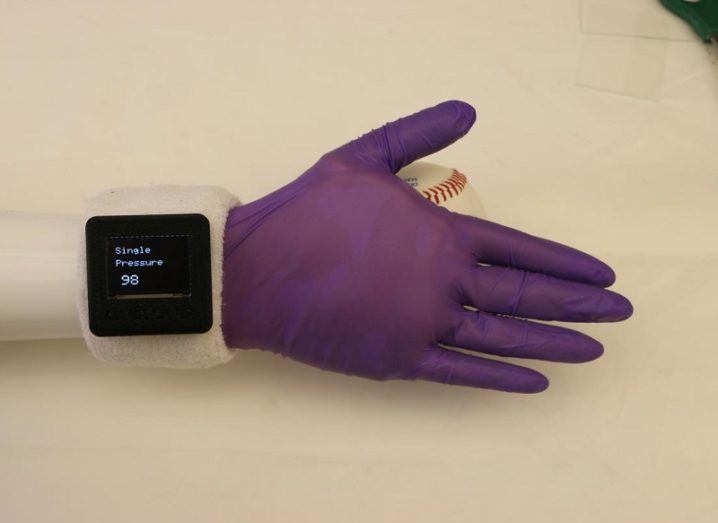 Purple e-glove on a prosthetic hand with smartwatch attachment against a white background.