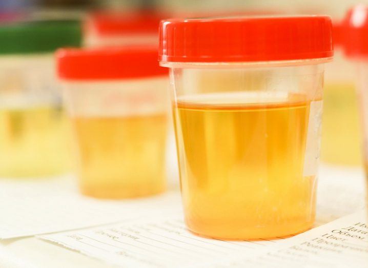 Plastic jars filled with urine samples in a lab.