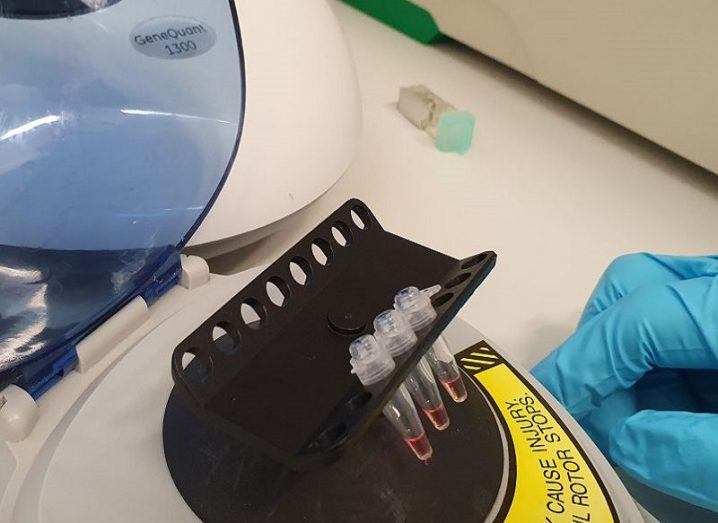 The coronavirus testing kit in a lab.