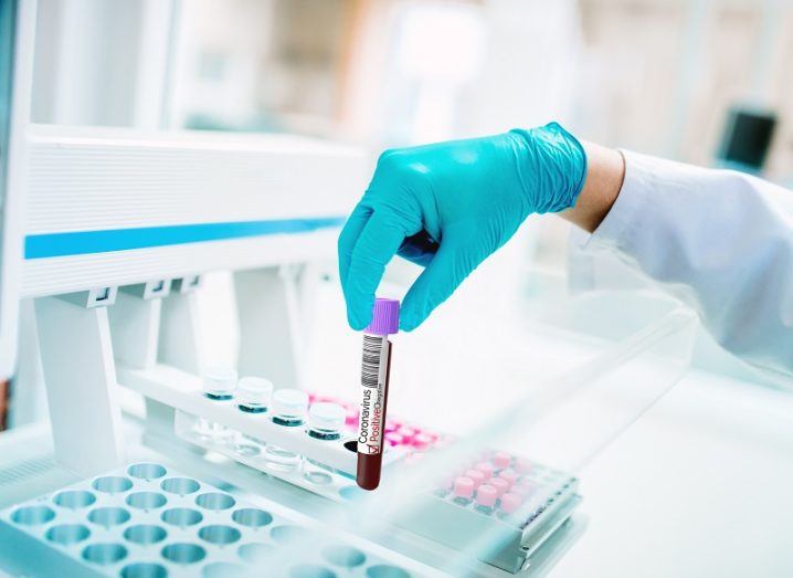 Researcher wearing a blue surgical glove holding a vial of blood in a lab.