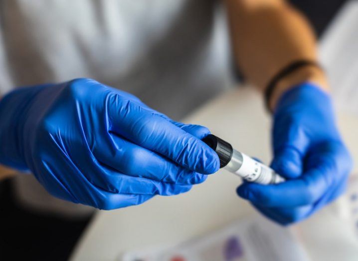 Scientist wearing blue gloves holding a SARS-CoV-2 swab test tube.