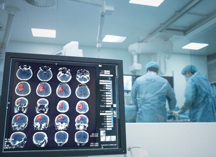 Screen showing images of a patient's brain, while surgeons work in the background.