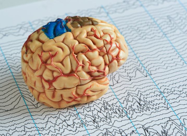 A 3D model of a brain on top of a piece of paper full of EEG waves.