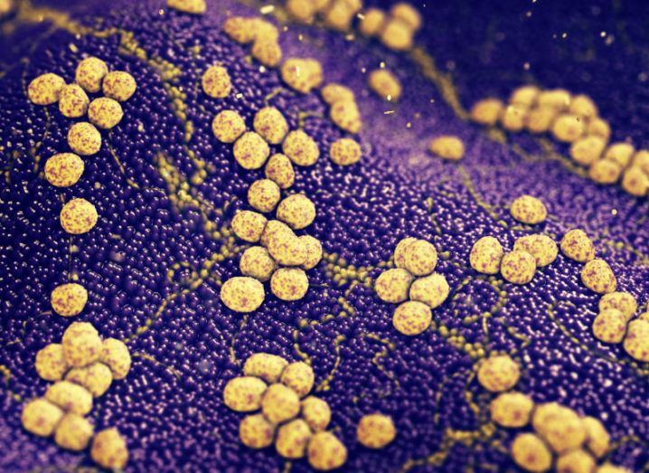 A visualisation of microscopic Staphylococcus aureus on the skin. The clusters of bacteria resemble groups of yellow spheres spread across the surface of the skin, which is represented in purple.