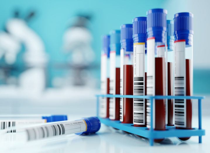 Rows of test tubes filled with blood are pictured in a rack. The tubes have a blue cap on them and have labels on the side. There are two empty test tubes in front of the rack. Microscopes can be seen in the background but are blurred and out-of-focus.