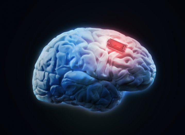 Illustration of a human brain with a chip implanted in it.