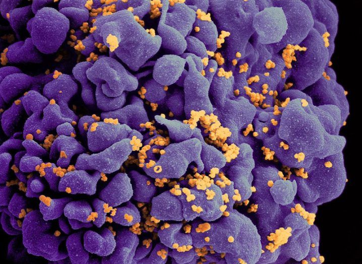 Up close image of a t cell infected with the HIV virus.
