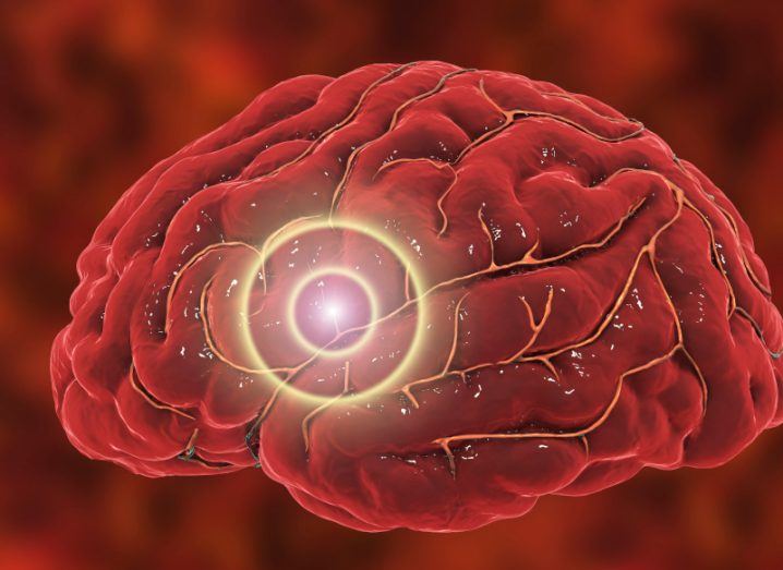 Brain stroke concept, a red brain with a circular light at a focused point.