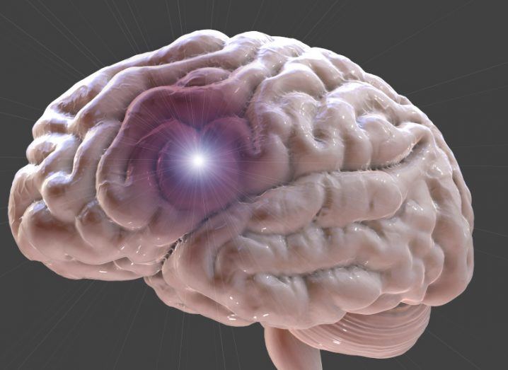 Image of a brain with a light in it meant to represent a stroke.