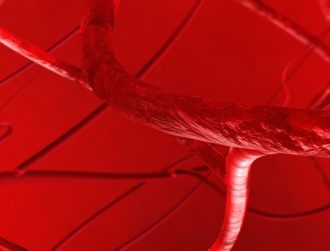 Galway’s Vivasure Medical raises €22m for its intravascular patch tech
