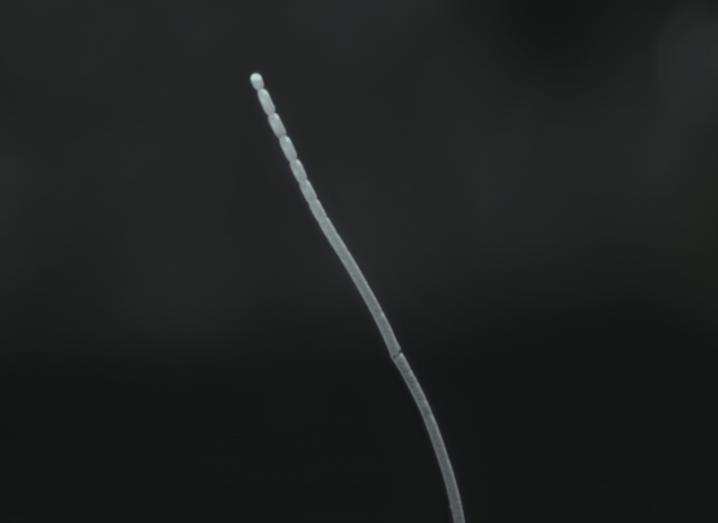 Image of a thin grey bacteria floating against a dark background. The image is a single strand of Thiomargarita magnifica, a giant bacteria that is the largest discovered to date.