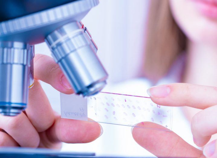 Scientists holding a slide next to a microscope. The slide is a histological sample, commonly used in cancer research.