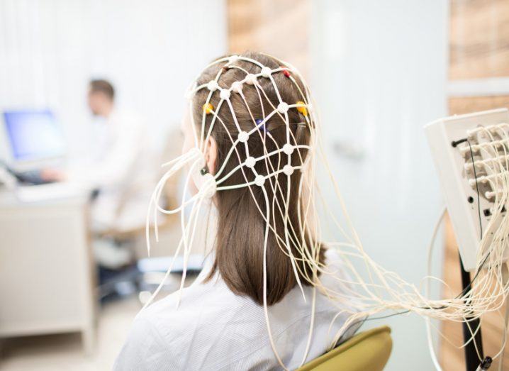 A patient with EEG equipment on her head, used to map brain activity.