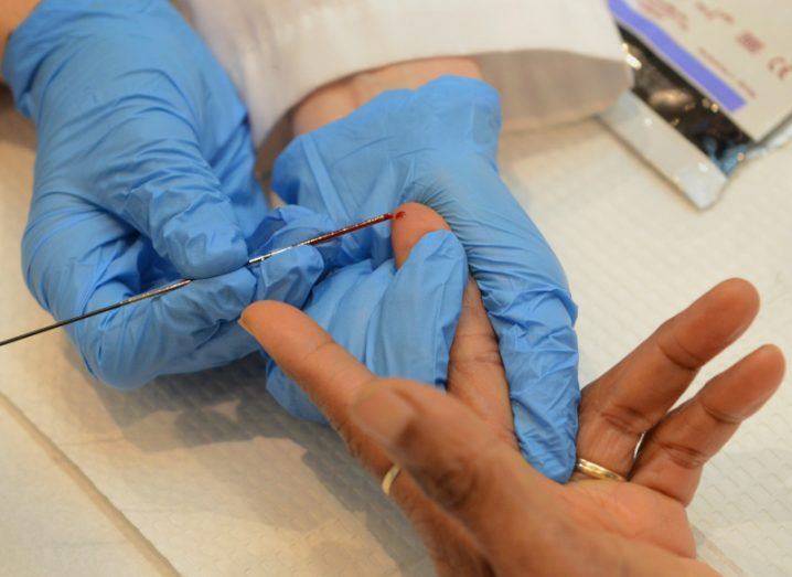 A person's hand being tapped with a needle, with a small amount of blood coming out of a finger. A person wearing medical gloves is holding the hand and taking blood with the needle.