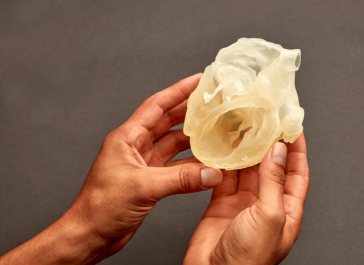 Photo of a 3D printed model of a human body part held in a person's hands.