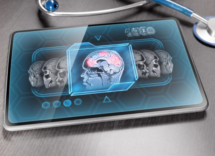 A digital tablet showing brain scans with portions of the brain highlighted in red. The tablet is laying on a grey metallic table with a stethoscope next to it.