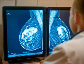 AI can help doctors detect 20pc more cases of breast cancer