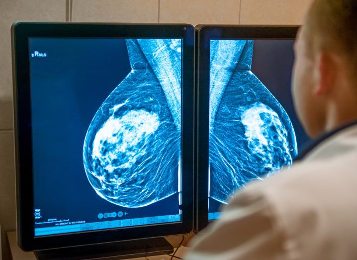A doctor examining a mammogram screening on a computer screen to detect breast cancer in a patient.