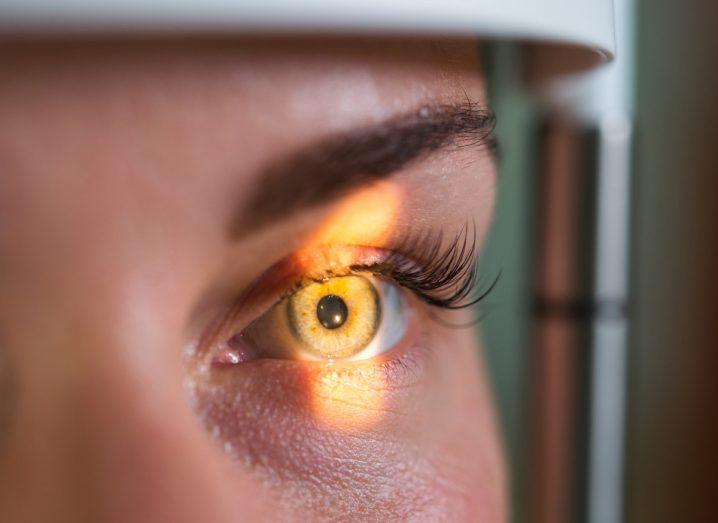 A woman's eye is being scanned with a bright light falling on her retina.