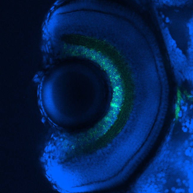 Close-up of an eye in blue with green spots.