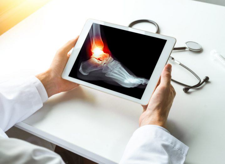 A doctor holding a tablet that has an x-ray of a foot, with red light coming from the ankle.
