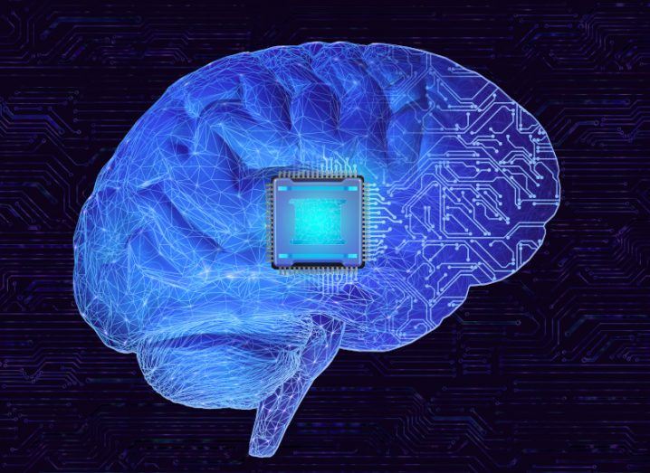 Illustration of a brain-computer interface on a brain.